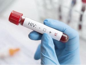 ¡APRUEBA UNIÓN EUROPEA FÁRMACO INYECTABLE PARA PREVENIR EL VIH!