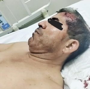 ¡EX COMANDANTE DE LA FUERZA CIVIL ESTÁ DETENIDO POR DESCALABRAR A MUJER POLICÍA!
