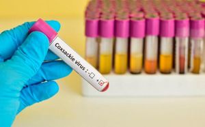 ¡VIRUS COXSACKIE EN VERACRUZ! - *Hay 71 casos atendidos en escuelas