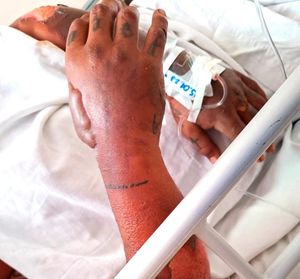 ¡LANZAN SOS POR YAHIR DE JESÚS NO LE BRINDAN ATENCIÓN EN EL IMSS!