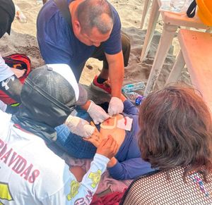 ¡TRES BALEADOS EN LA PLAYA! - PISTOLEROS ATACARON A COMERCIANTE Y VARIOS DISPAROS IMPACTARON A DOS TURISTAS