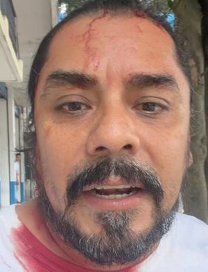 ¡MÚSICO HERIDO AL ENFRENTAR A LADRÓN DE AUTOS!