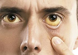 ¡ALERTA IMSS VERACRUZ NORTE SOBRE TIPOS DE HEPATITIS Y SUS RIESGOS!