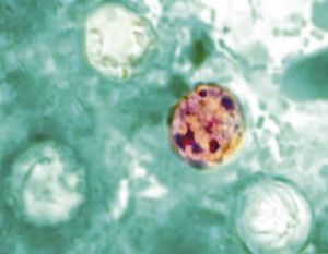 ¡MUEREN DOS PERSONAS EN MICHIGAN POR BROTE DE CICLOSPORIASIS!