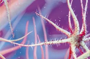 ¡ALERTA POR BACTERIA 'COME CARNE'!
