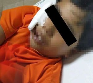 ¡PERRO MORDIÓ EN EL ROSTRO A NIÑO!