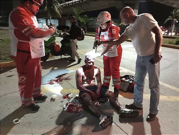 ¡DERRAPÓN Y TERMINA EN EL HOSPITAL! -UN TAXISTA LO ENCONTRÓ HERIDO EN DÍAZ MIRÓN