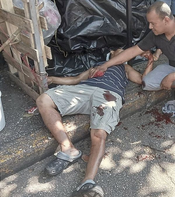 ¡TIROTEAN A UN FRANELERO EN EL MERCADO MORELOS DE COATZACOALCOS! -ALFREDO RECIBIO 4 BALAZOS Y EL AGRESOR ESCAPO