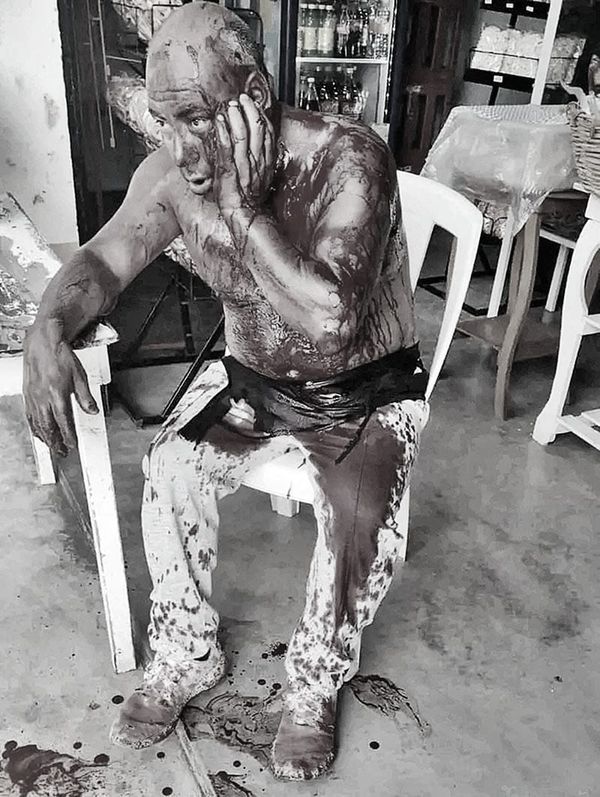 ¡LE METEN 17 CUCHILLADAS EN LA CANTINA! -*El agresor huyó corriendo mientras el herido desangrándose pidió ayuda en una tienda de abarrotes...