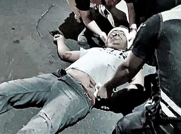 ¡MOTOCICLISTA SE DEBATE ENTRE LA VIDA Y LA MUERTE! - |IBA SIN CASCO Y CHOCO DE FRENTE CONTRA UNA CAMIONETA