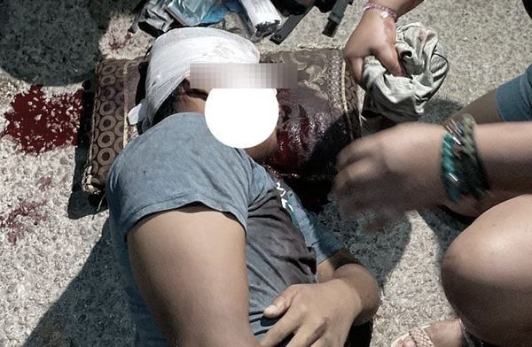 ¡DOS ESTUDIANTES IBAN EN LA MOTO... MATÓ A UNO, EL OTRO HERIDO! - *EL TAXISTA ABANDONÓ EL VEHÍCULO MÁS ADELANTE