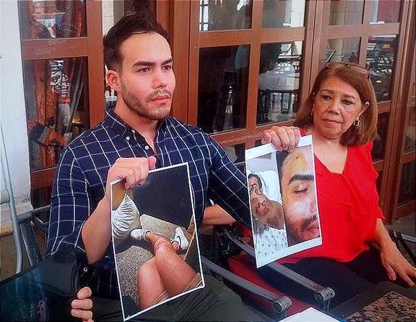 ¡FRITZ SOBREVIVIÓ A CAÍDA DE 3 PISOS, EXIGE JUSTICIA!