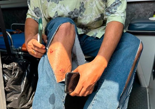 ¡JAURÍA DE PERROS ATACA A HOMBRE DE LA INDIA! - *CAMINABA RUMBO A SU CASA EN EL FLORESTA