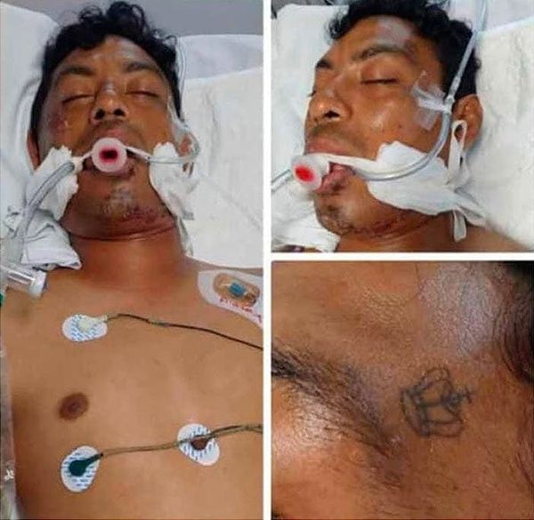 ¡ATROPELLADO EN LA SALIDA NORTE! - *BUSCAN A SUS FAMILIARES