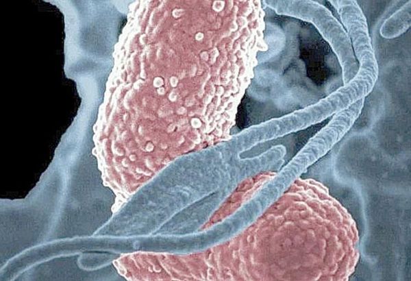 ¡TRECE NIÑOS MUEREN POR BROTE DE LA BACTERIA KLEBSIELLA OXYTOCA!