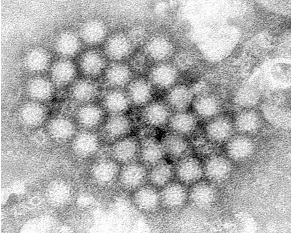 ¡EL NOROVIRUS REGRESA CON FUERZA Y LOS CASOS EN ESTADOS UNIDOS AUMENTAN NOTABLEMENTE!