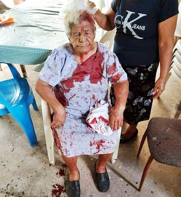 ¡A VARILLAZOS DESCALABRA A UNA ABUELITA DE 97 AÑOS!