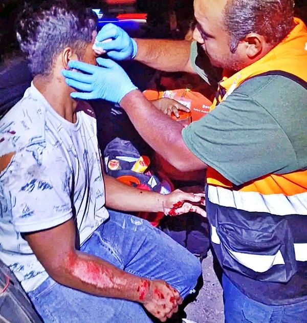 ¡“JINETE” MOTORIZADO DEJÓ “MEDIO CACHETE” EN EL PAVIMENTO!