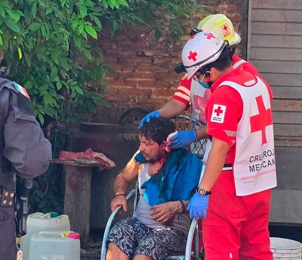 ¡EL “LEO” HIRIÓ A MACHETAZOS A “EL TERRY”!