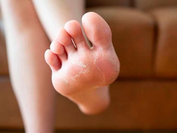 ¡PIDEN ESPECIALISTAS DEL IMSS CUIDAR LOS PIES!