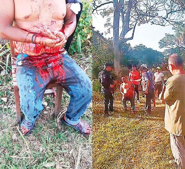 ¡LE VUELAN UN DEDO DE UN MACHETAZO!