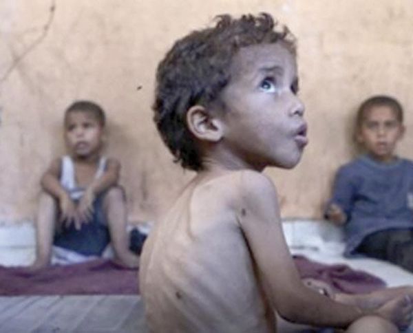 ¡GAZA SE MUERE DE HAMBRE! - ONU