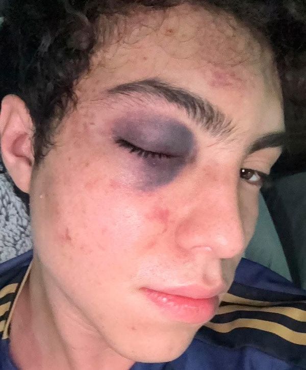 ¡NOQUEAN A ACTOR DE DOBLAJE EN EL WTC DE BOCA DEL RÍO! - DIJO QUE SU COPA ESTABA “BUENA” Y FUE GOLPEADO POR UN HOMBRE QUE PASABA CON SU NOVIA