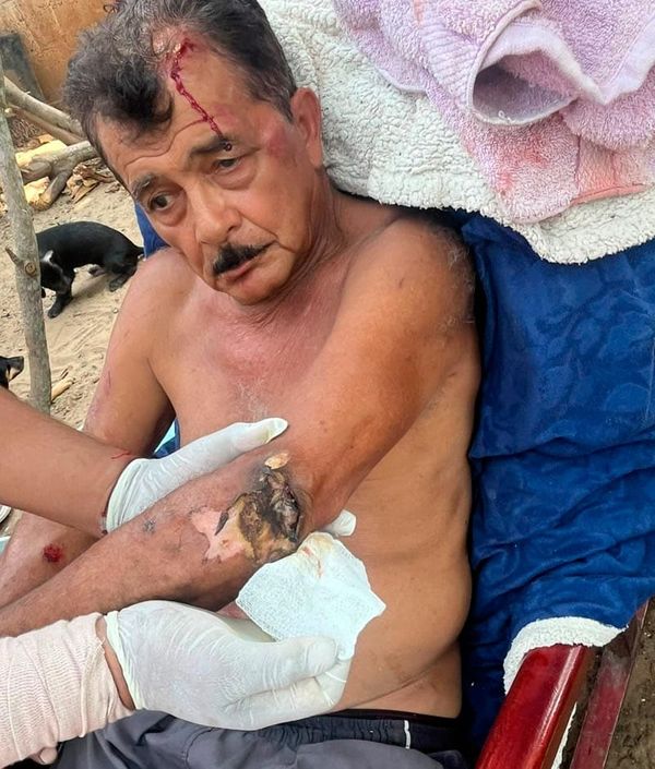 ¡SOBREVIVIÓ A DESCARGA ELÉCTRICA Y CAÍDA DE ÁRBOL!