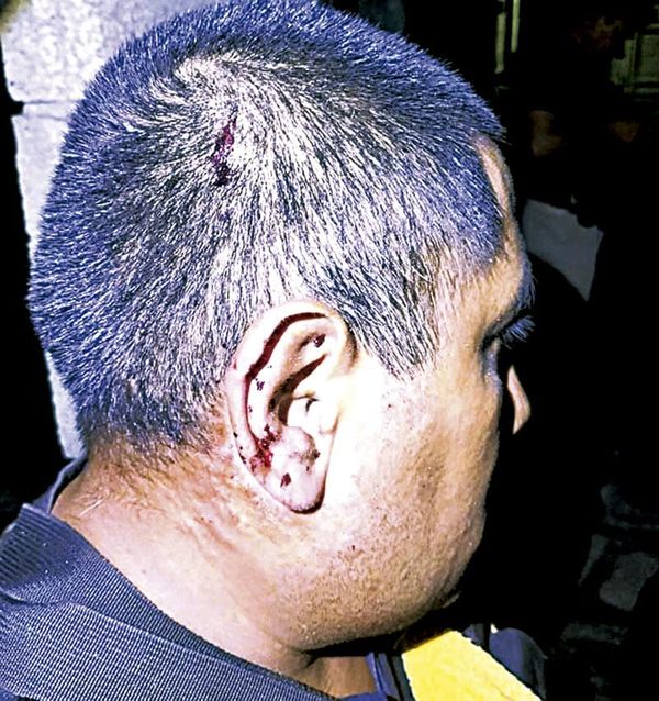 ¡ATACAN A LA POLICÍA! - LE LANZAN EXPLOSIVO DESDE UN DRON