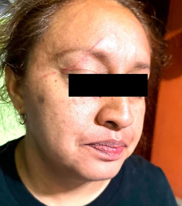 ¡DENUNCIAN A LA POLICÍA DE SOLEDAD DE DOBLADO!