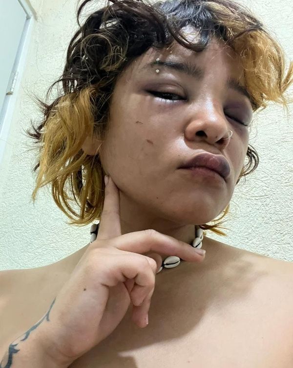 ¡JOVENCITA DENUNCIÓ QUE LE DIERON UNA GOLPIZA DENTRO DEL “MUTE BAR”!