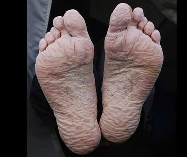 ¡ALERTA IMSS POR PIE TRINCHERA!