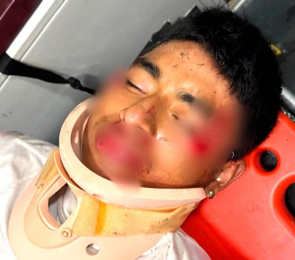 ¡OBRERO ARROLLADO POR UN “OVNI” EN PASO DEL MACHO!