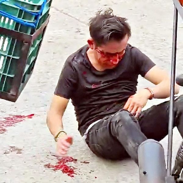 ¡CON TREMENDA GOLPIZA DESFIGURAN A “EL PONY”!