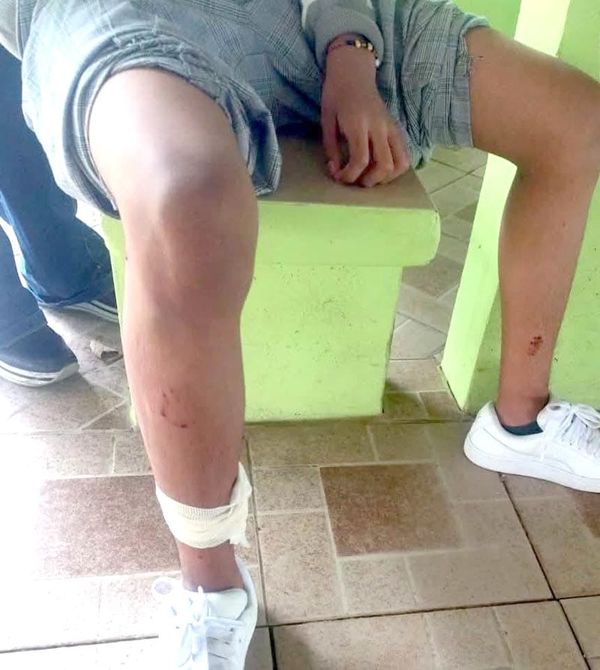 ¡DE TERROR! - ATACAN PITBULLS A ESTUDIANTES