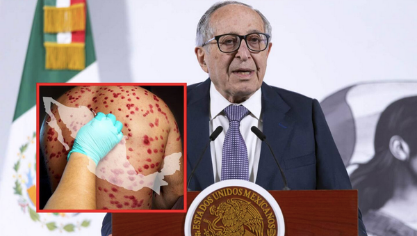 ¡FOCOS ROJOS POR EL SARAMPIÓN!