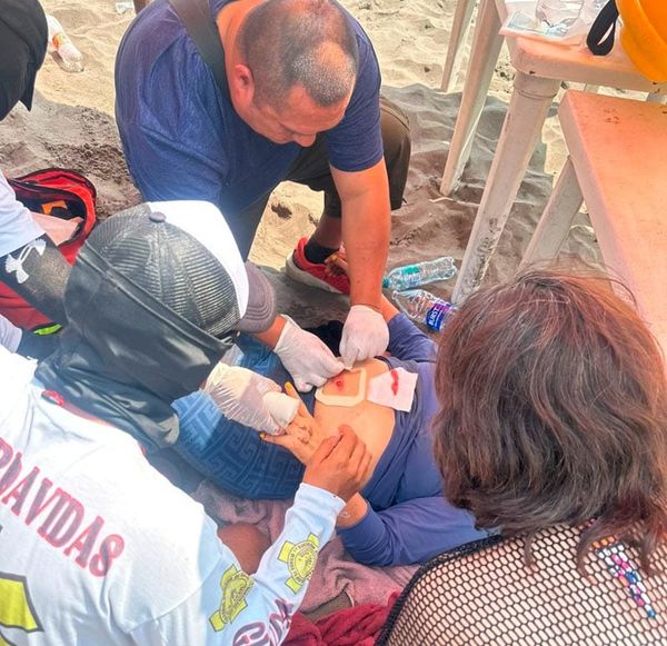 ¡TRES BALEADOS EN LA PLAYA! - PISTOLEROS ATACARON A COMERCIANTE Y VARIOS DISPAROS IMPACTARON A DOS TURISTAS