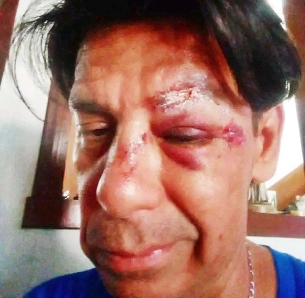 ¡BORRACHITO GOLPEADO Y ASALTADO POR TAXISTA!