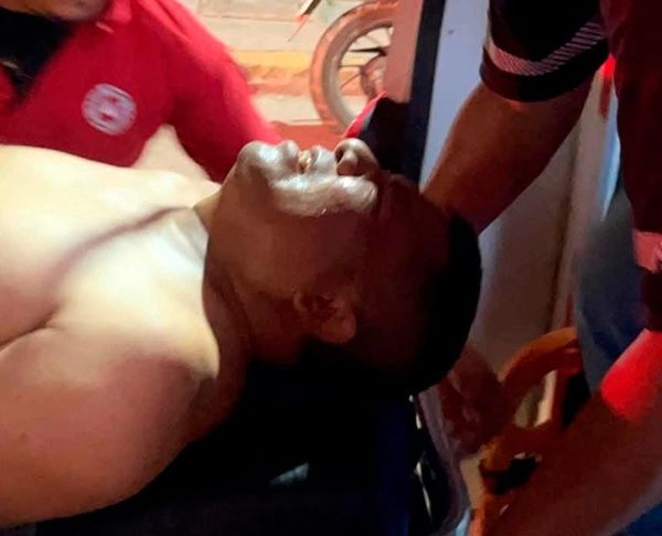 ¡EXALCALDE DE SOCONUSCO SOBREVIVIÓ A SIETE BALAZOS!