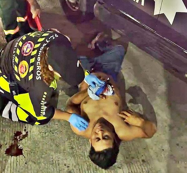 ¡DE UN MACHETAZO DEJARON ‘MOCHO’ AL ALBAÑIL!