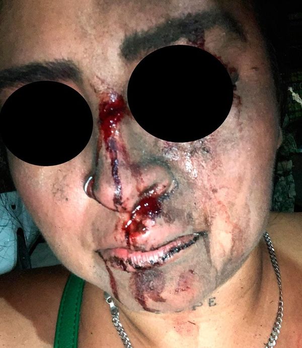 ¡DAMA QUISO METER PAZ Y “EL FIRE” SE LA SURTIÓ A CHINGADAZOS!