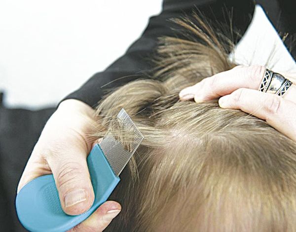 ¡ALERTAN POR EL AUMENTO DE CASOS DE PIOJOS EN NIÑOS Y NIÑAS ESCOLARES!