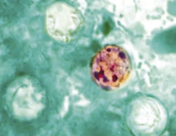 ¡MUEREN DOS PERSONAS EN MICHIGAN POR BROTE DE CICLOSPORIASIS!