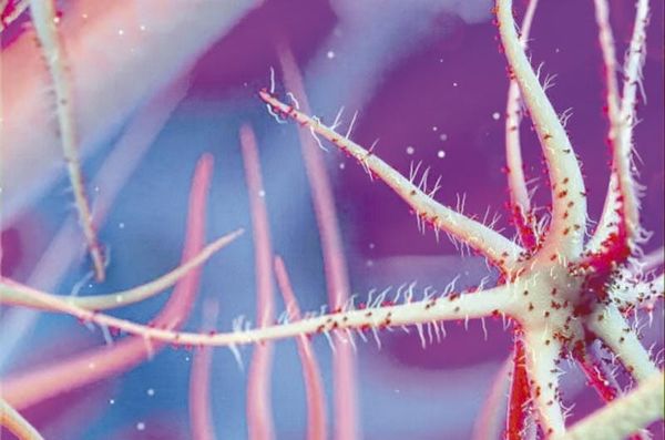 ¡ALERTA POR BACTERIA 'COME CARNE'!