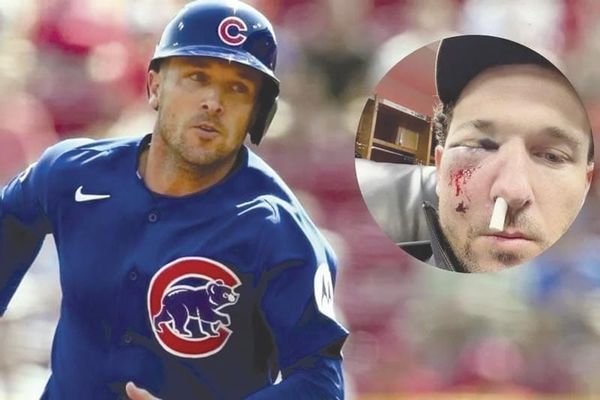 ¡ALEX BREGMAN RECIBE FUERTE PELOTAZO EN LA CARA CON LOS CUBS!
