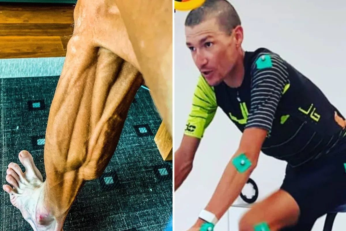 Sports Dietician Reports Increase in Cyclist Eating Disorders