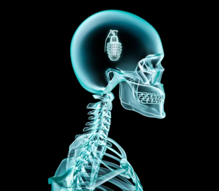 The Overactive Conservative Imagination Is Killing Us