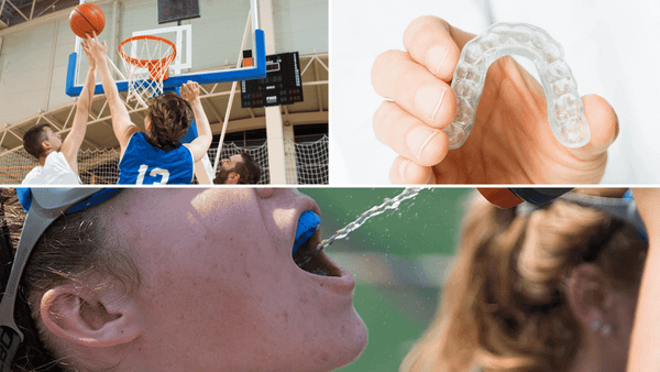 basketball mouthguard