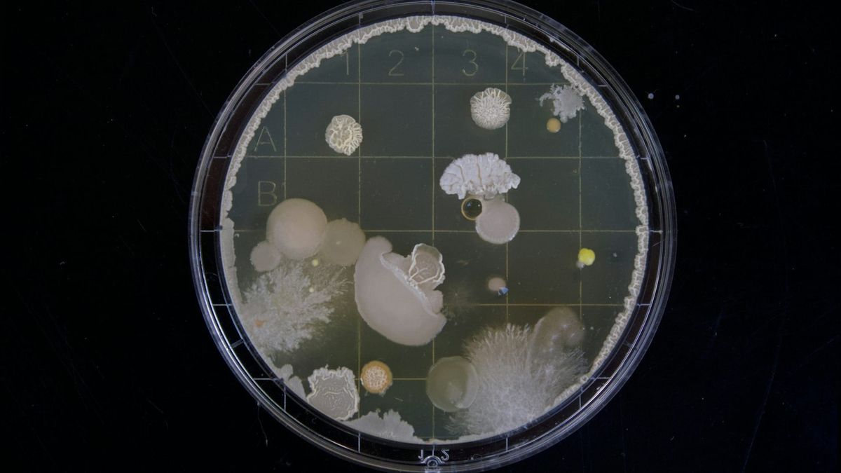 Parasitic Infections and Arthritis: The Dark Side