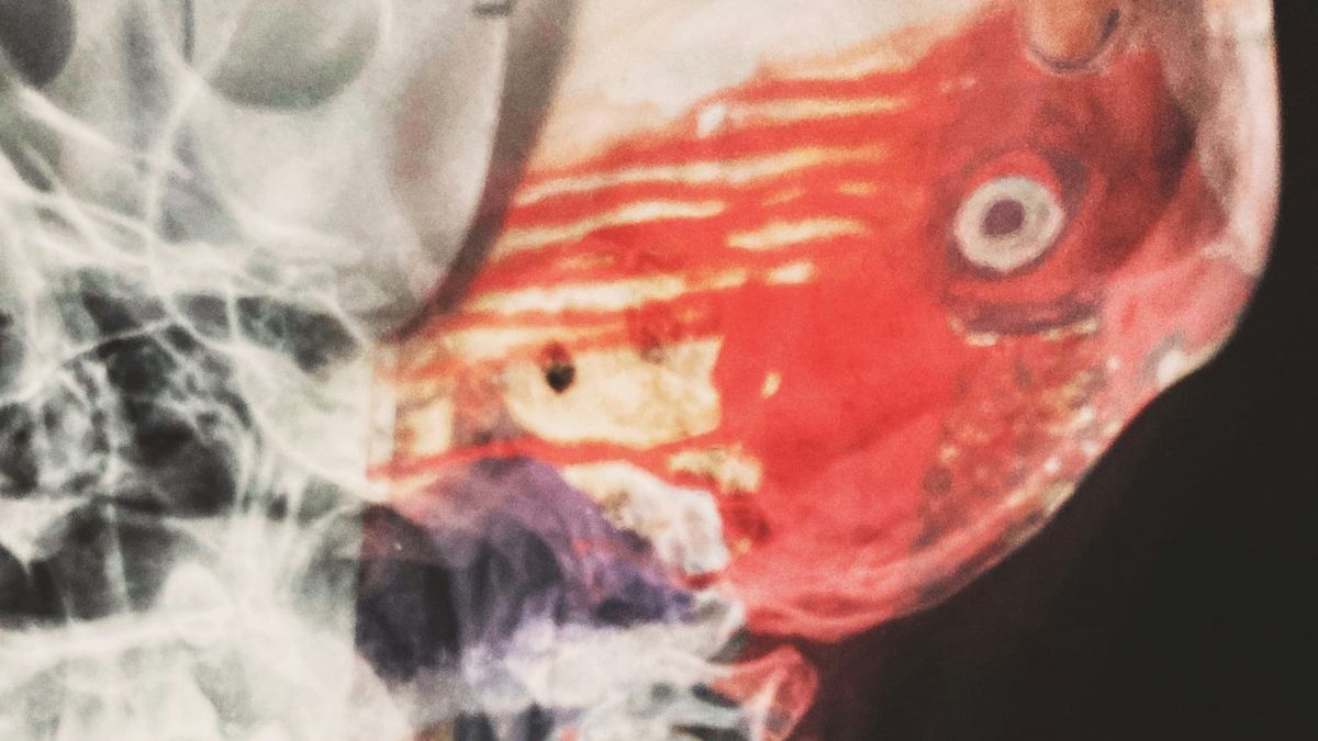 Rewiring Hope and The Unexpected Ally in Your Brain's Fight Against Tumours